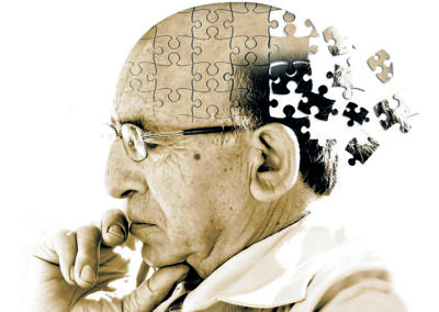 I test per l’Alzheimer vanno cambiati?