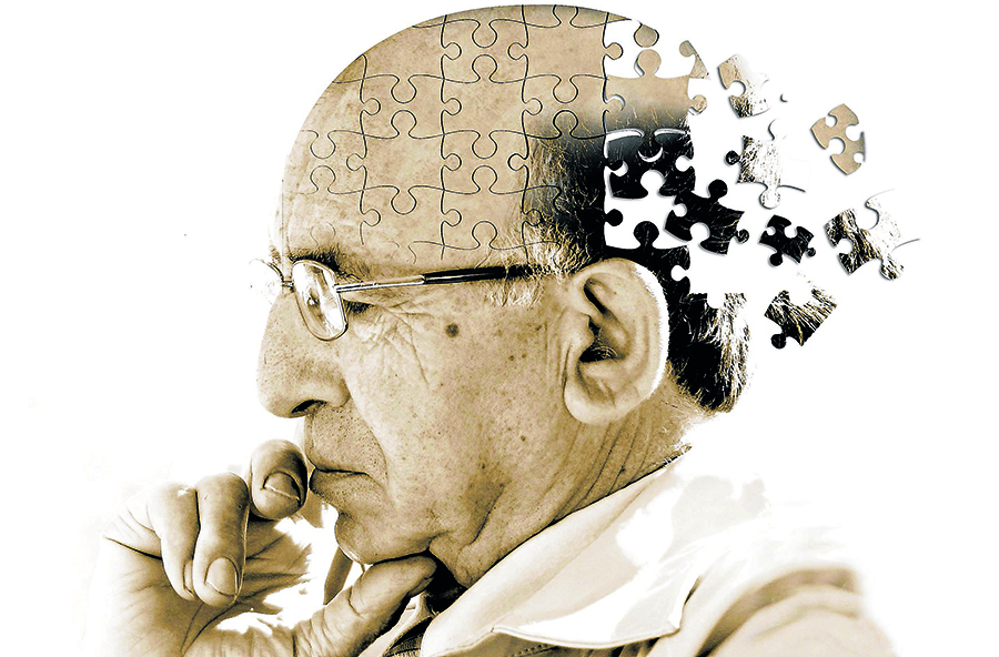 I test per l’Alzheimer vanno cambiati?