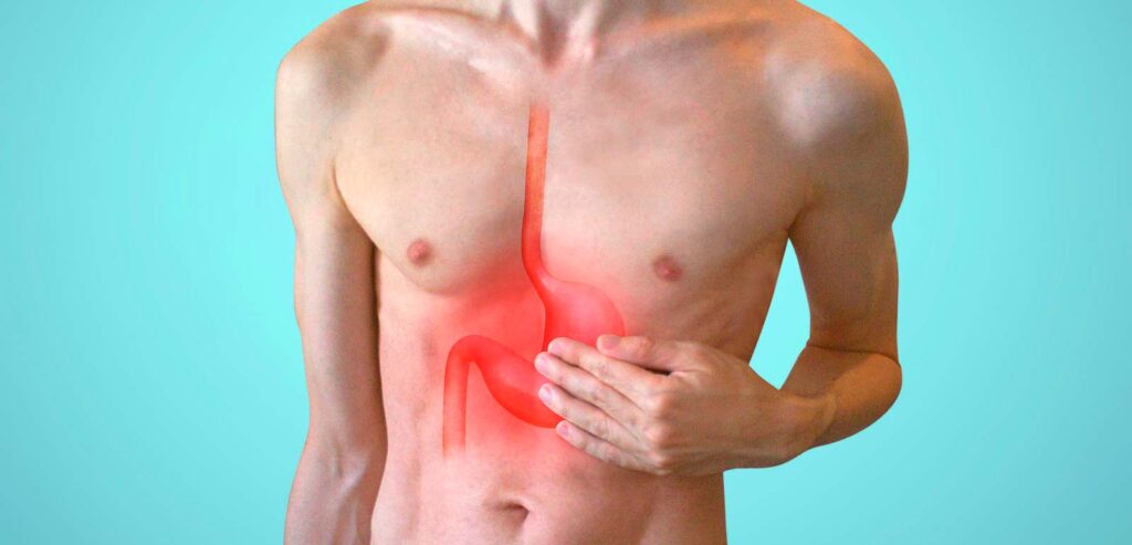 Reflusso-gastroesofageo-rimedi-naturali