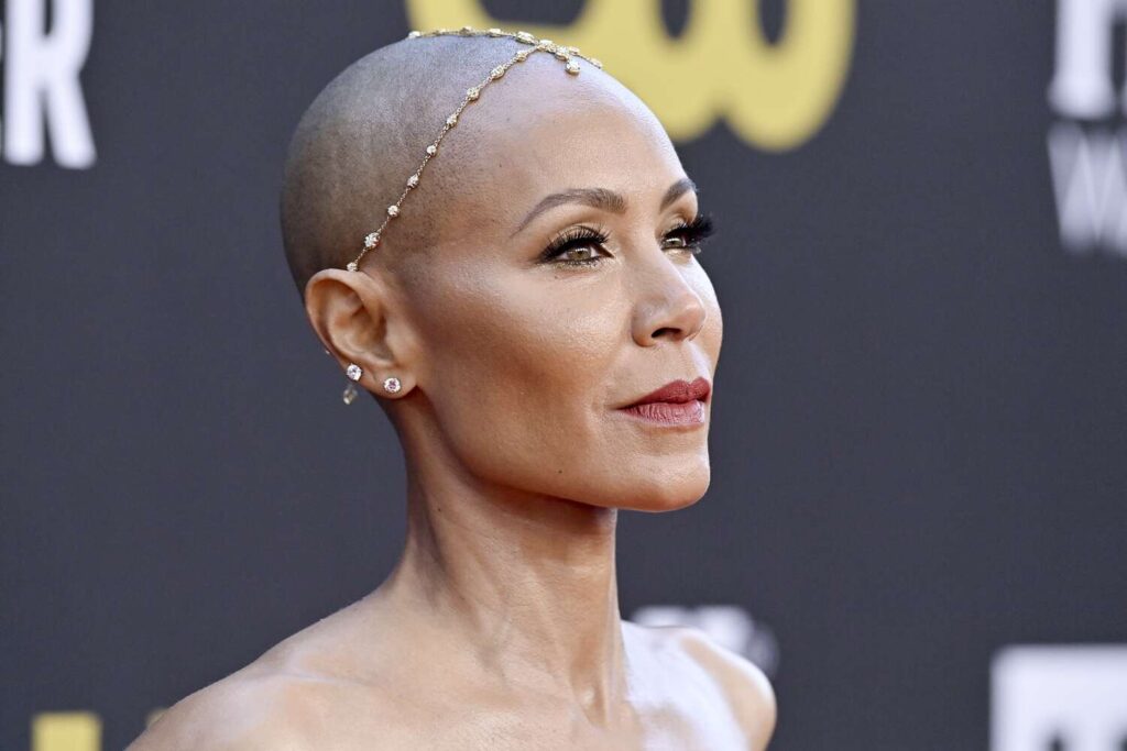 Jada Pinkett Smith e l'alopecia femminile