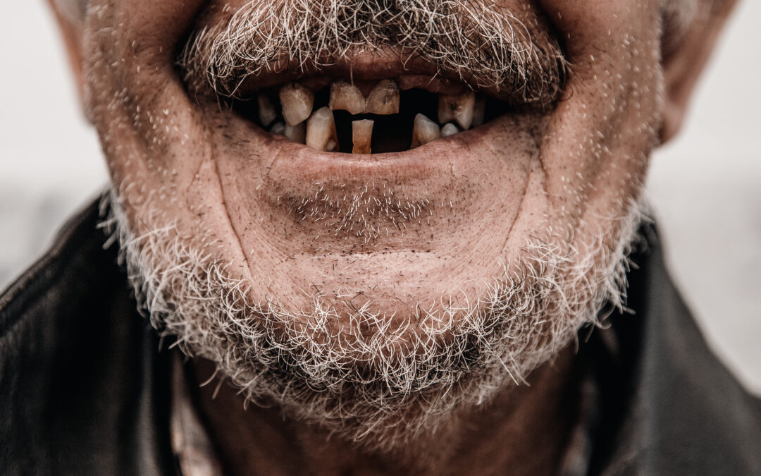 L’odontoiatria per anziani è una cosa da ricchi