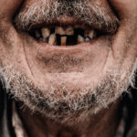 L'odontoiatria per anziani è una cosa da ricchi