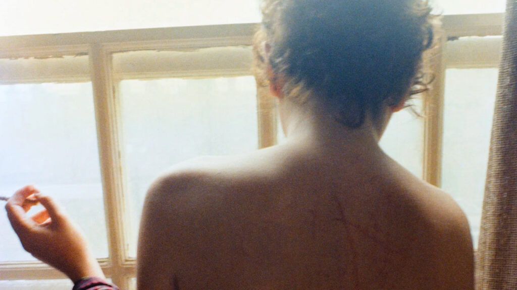 L'arte che si batte contro la dipendenza dai farmaci