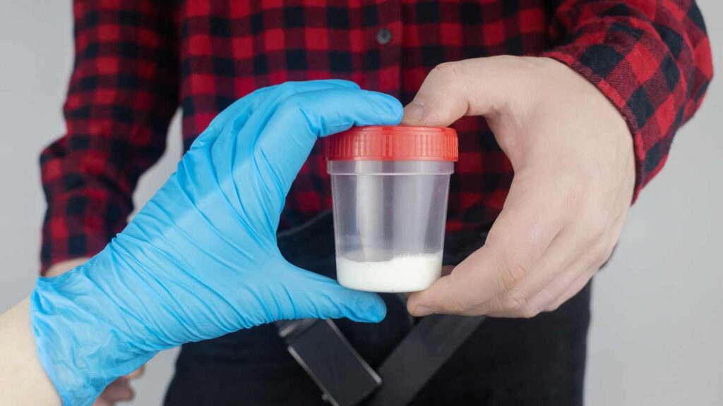 Il Covid danneggia la fertilità maschile: lo studio