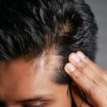 Omeopatia per la caduta dei capelli: approfondiamo