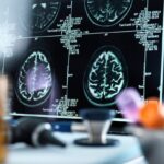 Omeopatia: la prova dell'efficacia nelle onde cerebrali