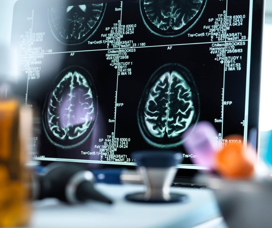 Omeopatia: la prova dell'efficacia nelle onde cerebrali