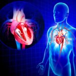 Pressione alta e Omeopatia: i rimedi naturali più diffusi