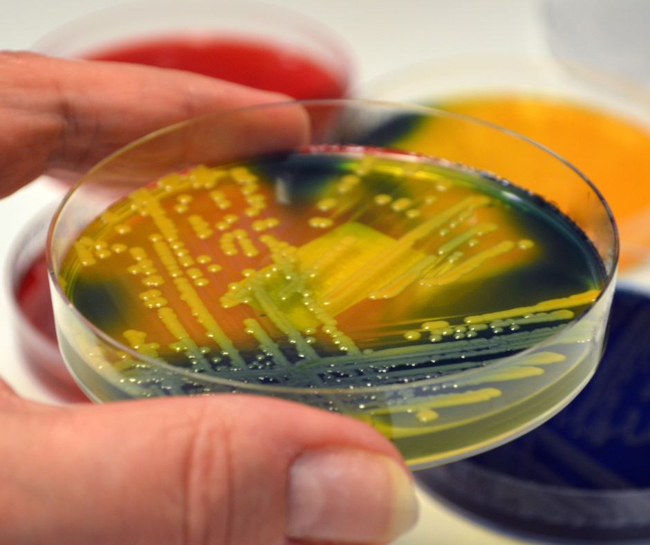 La battaglia contro i super-batteri passa per l'Omeopatia