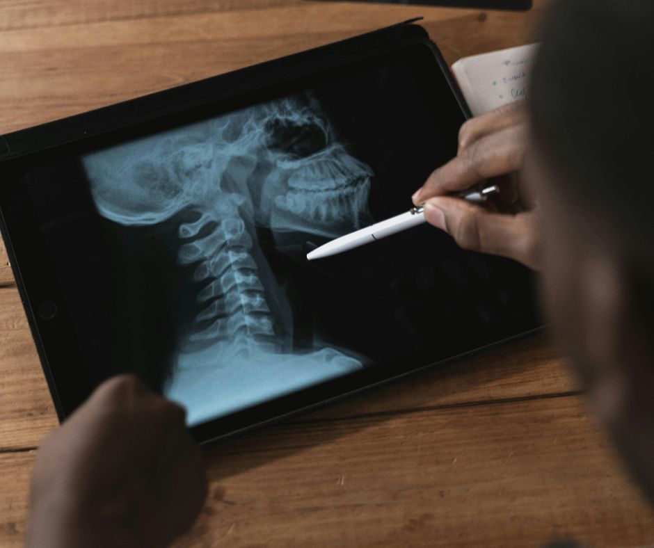 Ernia cervicale senza bisturi: la medicina coreana sfida la chirurgia